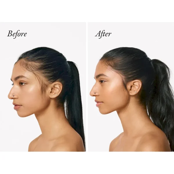 Serene Scalp Densifying Treatment Spray - Image 5